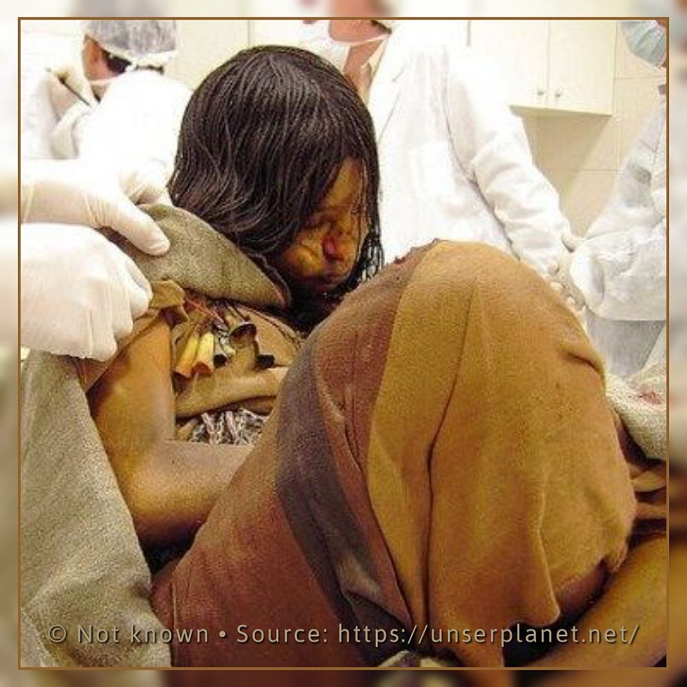 Die am besten erhaltene Mumie der Geschichte: 500 Jahre altes Mädchen mit Blut in ihrem Körper
